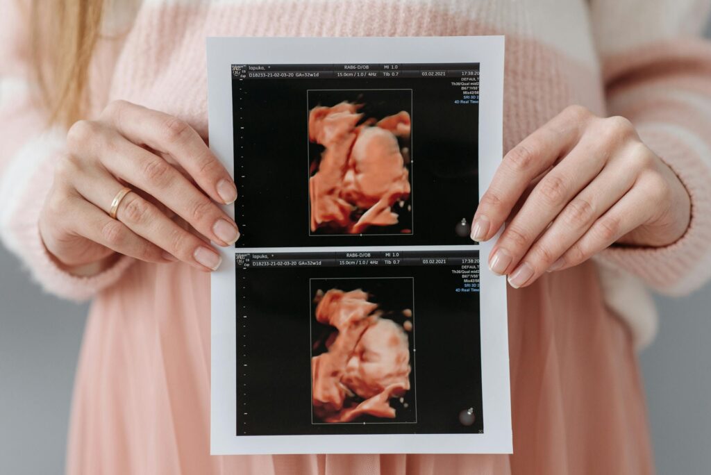 Close-up of a pregnant woman holding an ultrasound printout, which can be added to baby keepsake box.